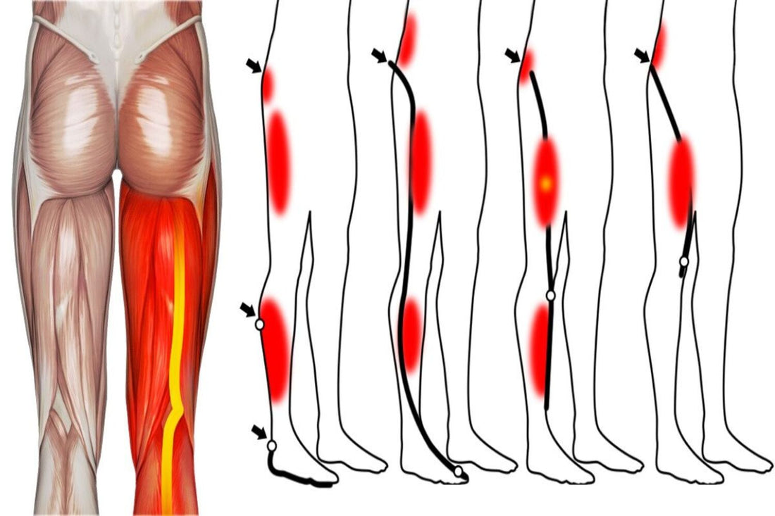 Ejercicios sencillos que alivian el dolor de piernas en un abrir y cerrar de ojos